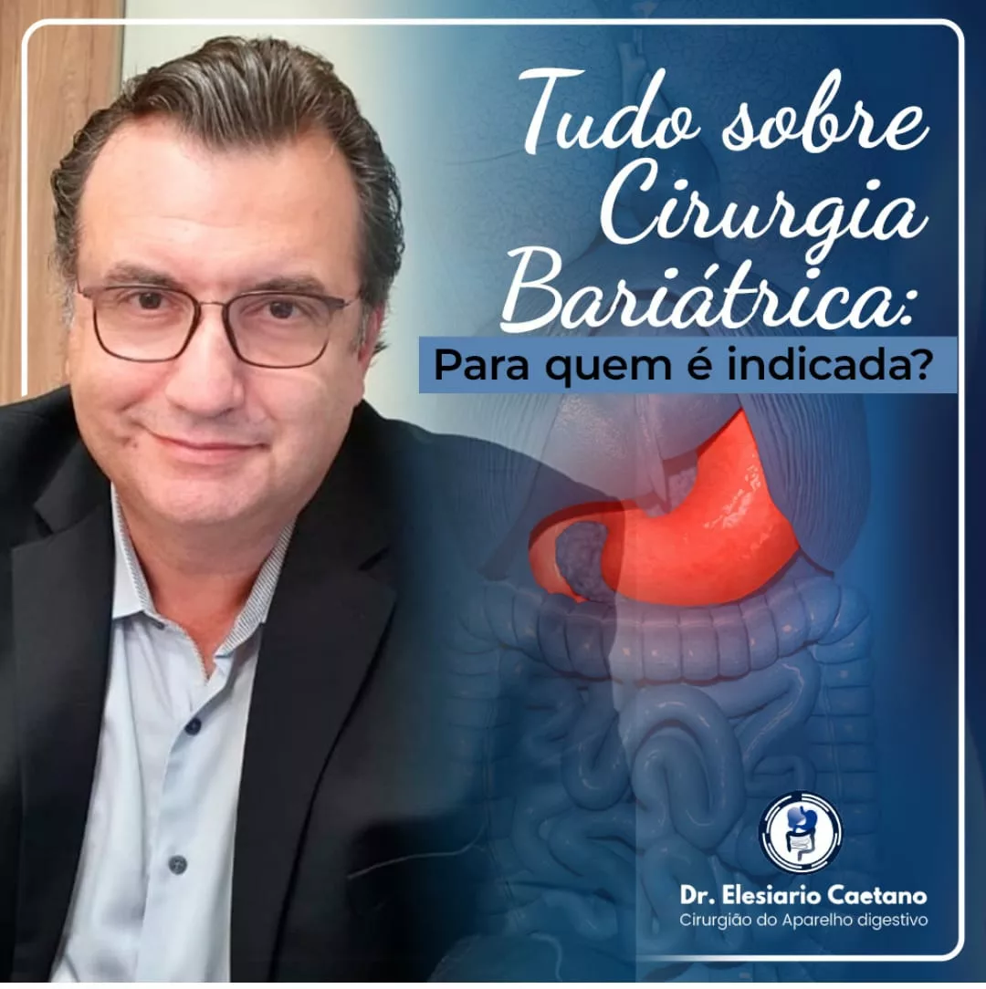 Tudo sobre Cirurga Bariátrica